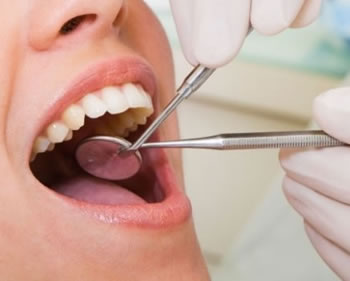 τακτικός οδοντιατρικός έλεγχος,αφαίρεση οδοντικής πλάκας και πέτρας